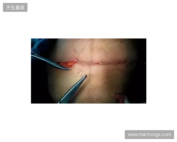 广州豹官方：杨浩眉弓伤口缝合30余针，预计5-7天后拆线